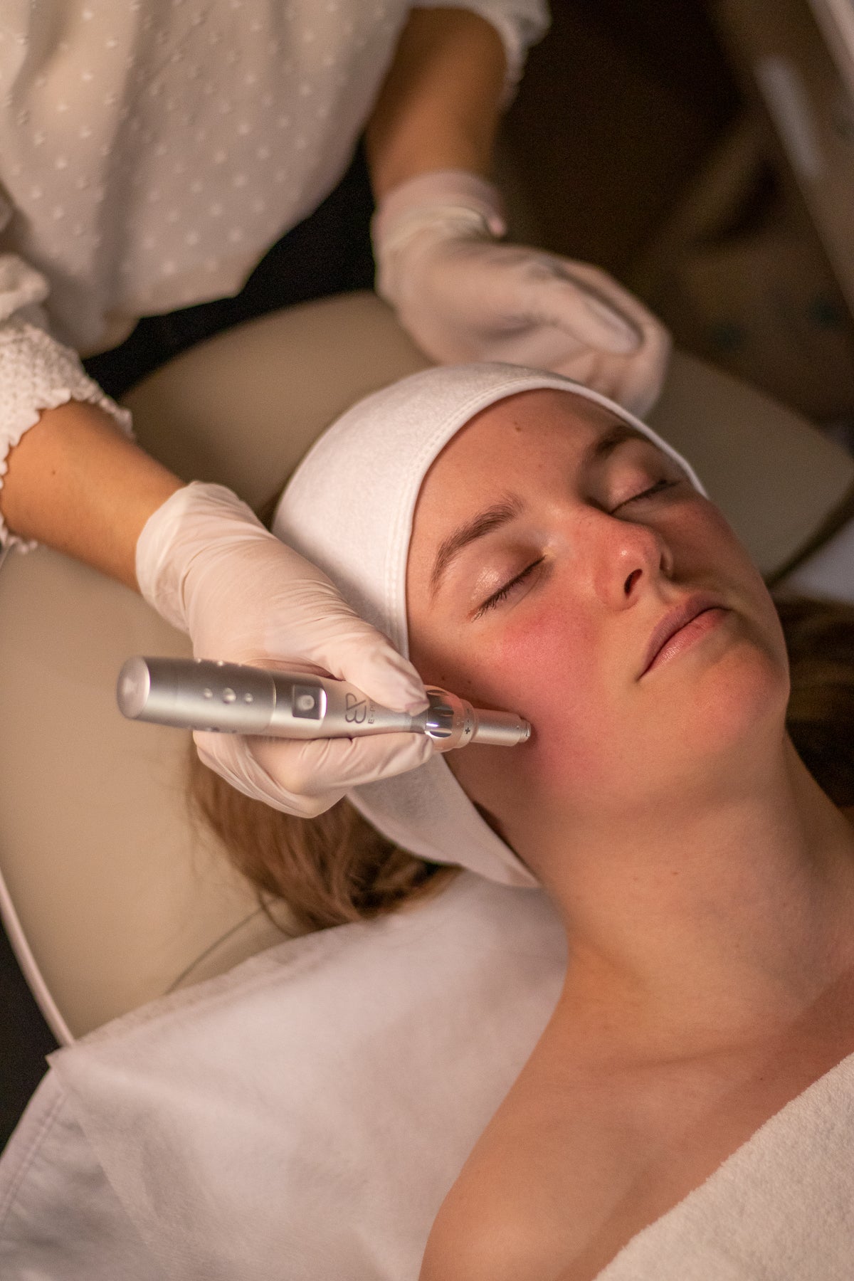 Microneedling Facial